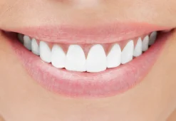 LED Technologies, LLC Healthy Gum Professional Teeth Whitening System