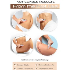 Fat Freezer 2-in-1 Cellulite Remover