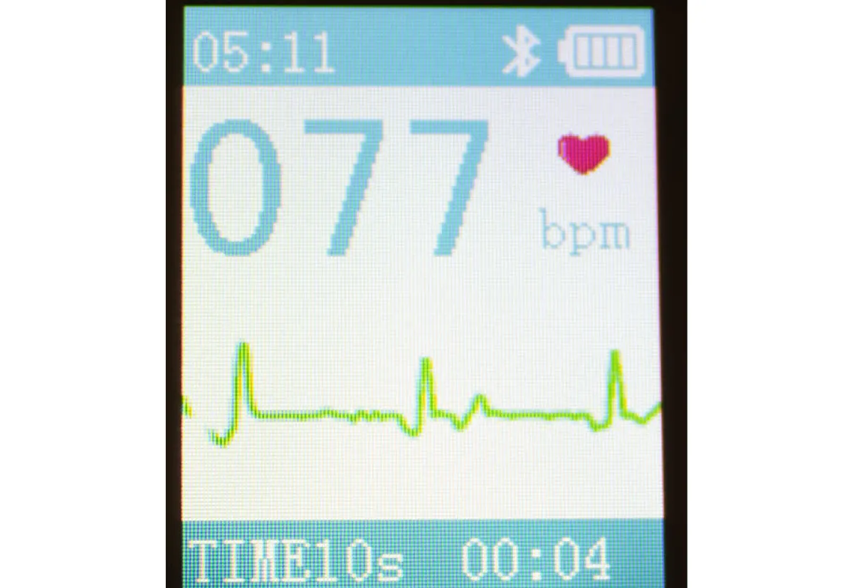 Jumper Medical Portable Smart Bluetooth EKG Monitor