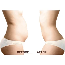 Beauty Ko LLC Ultimate Fat Freezer
