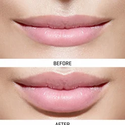 Prospera Corporation World's First At-Home Professional LED Lip Therapy Device
