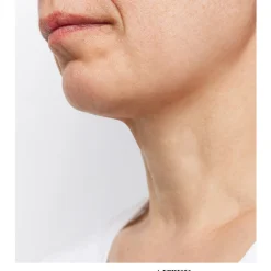 sharper image Wrinkle Reducing Neck Therapy Device